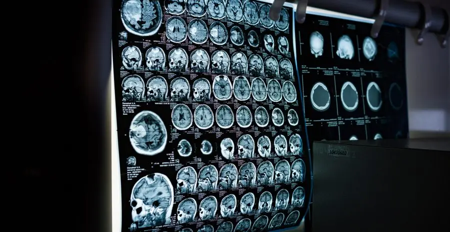 mitrey-x-ray-6841384