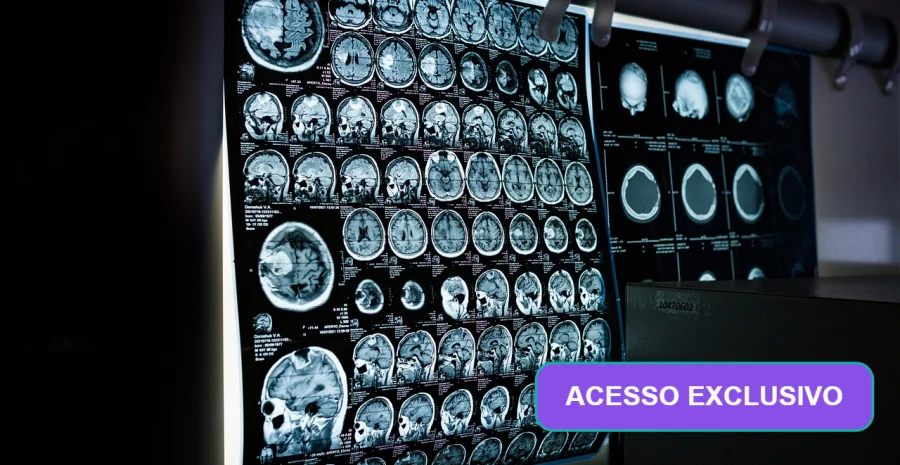 artigo-premium-dbr-tept-tronco-encefalico